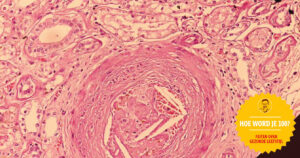 Niet minder maar beter cholesterol